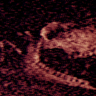 铁肺(主播同款)