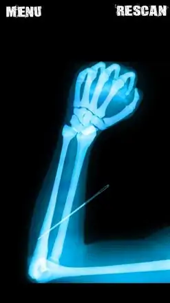 模拟器X射线手笑话