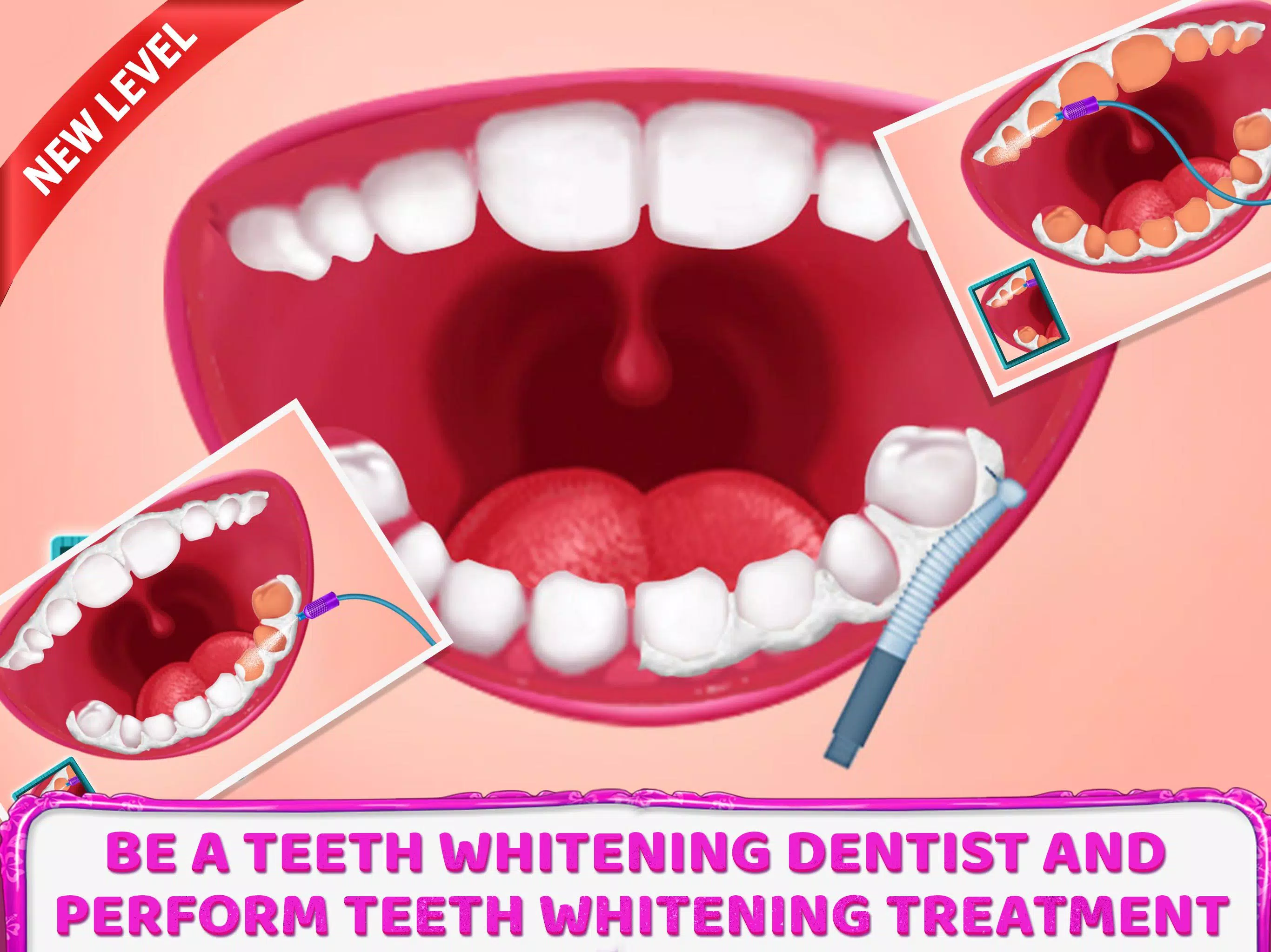 牙医ASMR沙龙女孩游戏