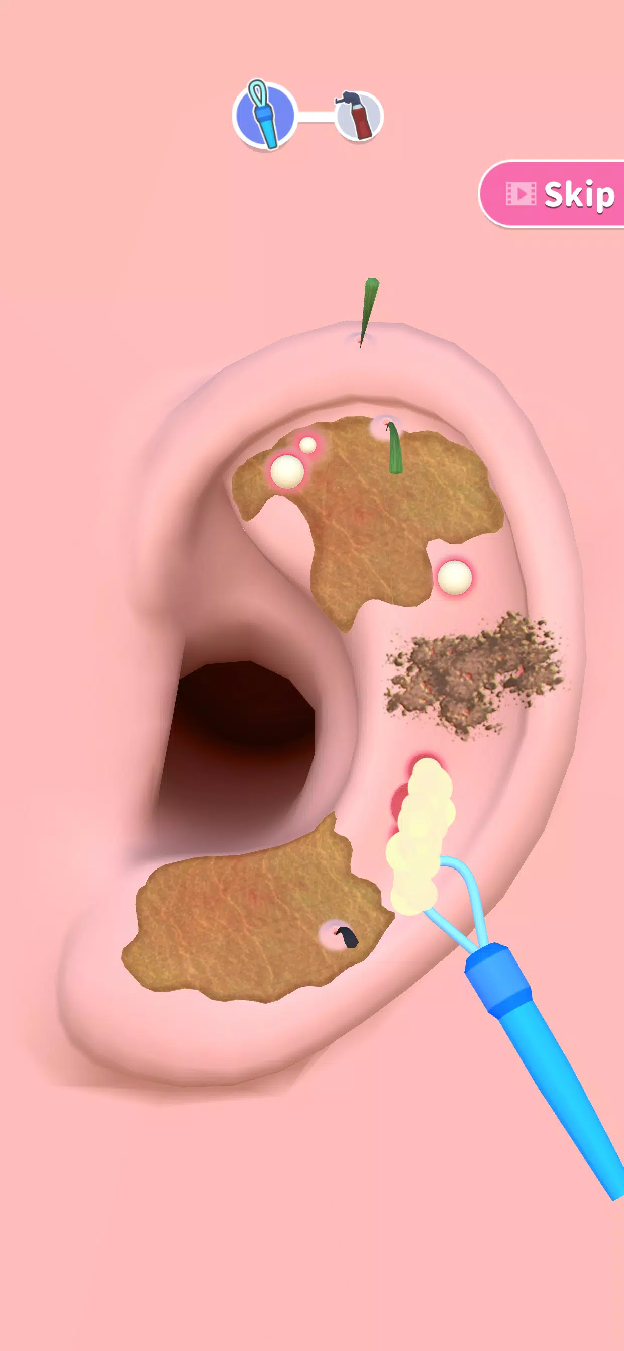 你是来掏耳屎的吧