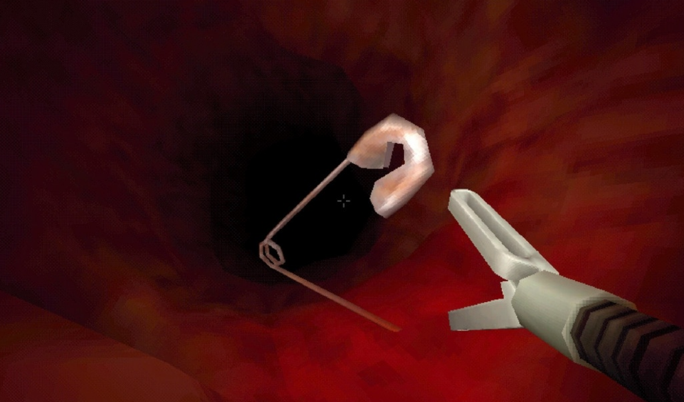 大肠的复仇 大肠的复仇