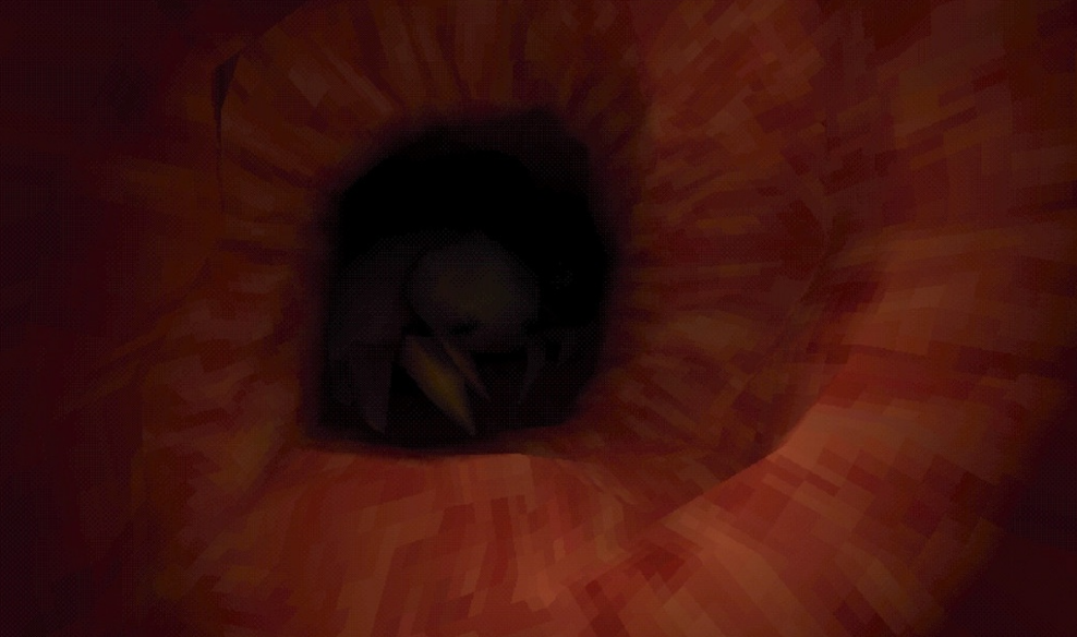 大肠的复仇 大肠的复仇