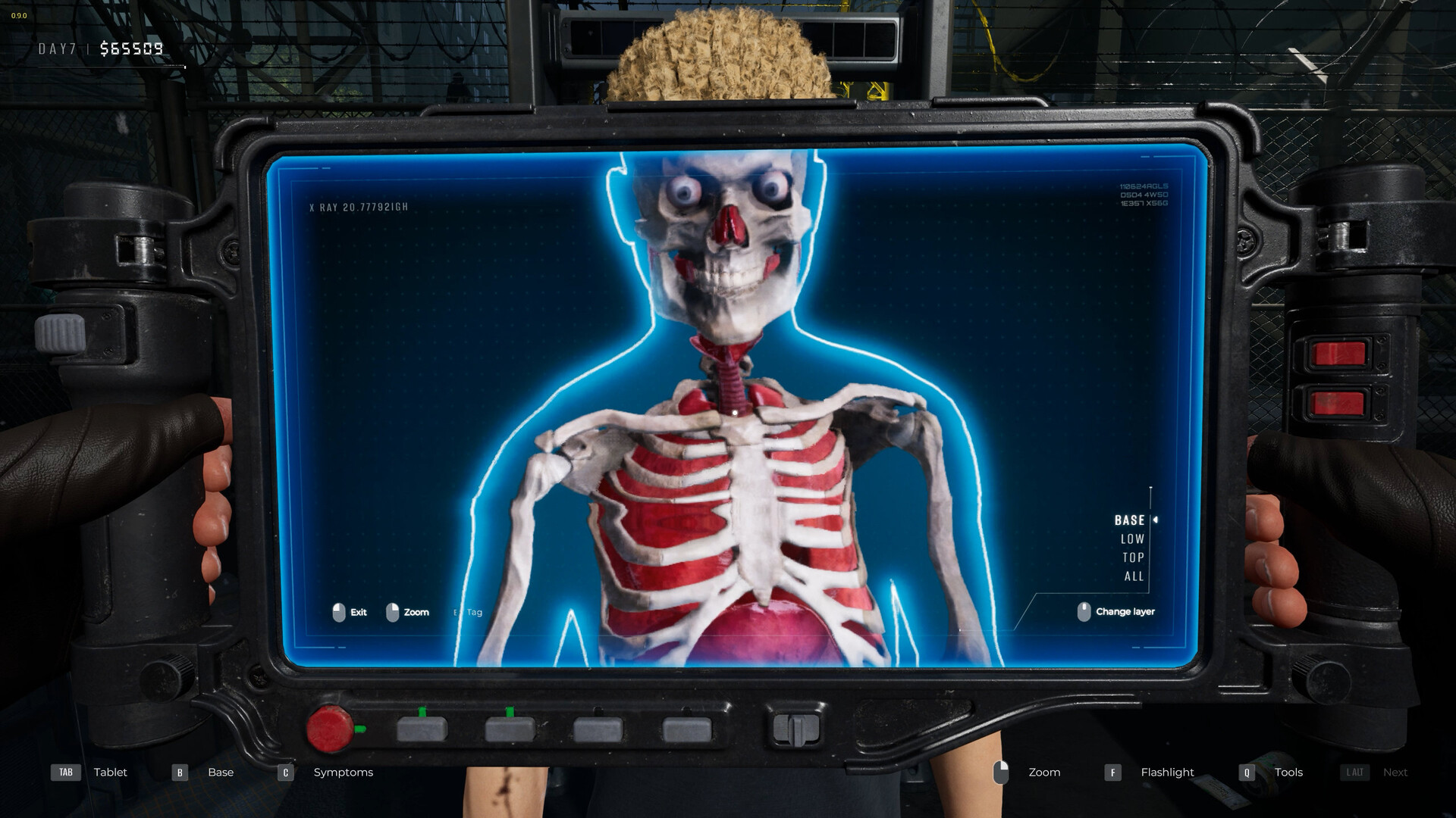 检疫区:最后一站