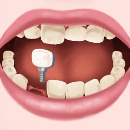 清洁牙齿解压游戏