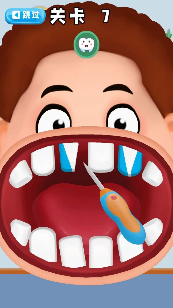 清理牙齿游戏